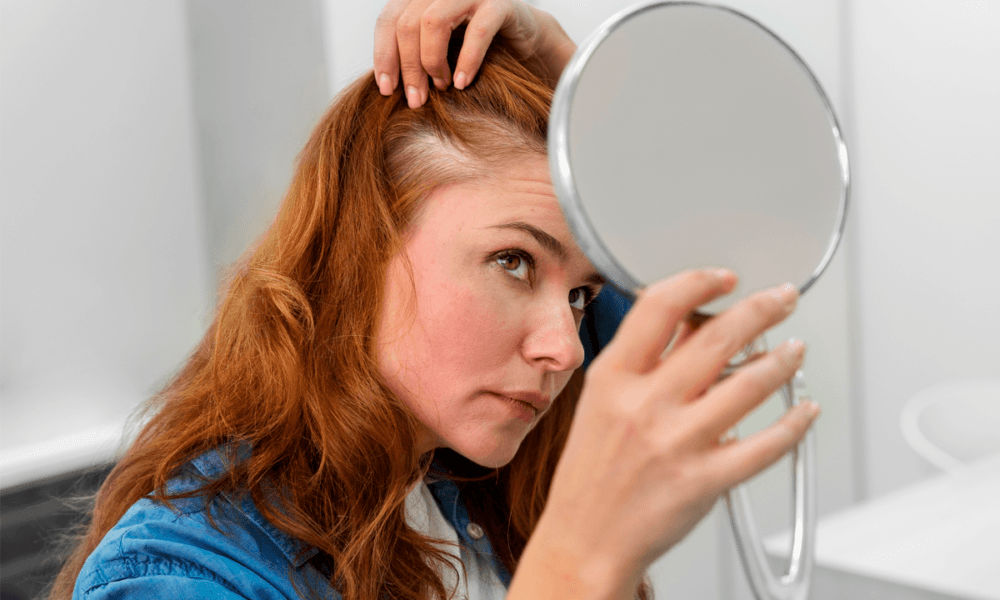 Estresse pode causar queda de cabelo