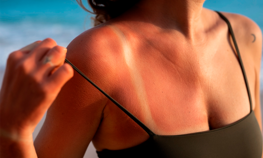 Pós-sol: descubra os benefícios e como incorporar em sua rotina nos dias quentes