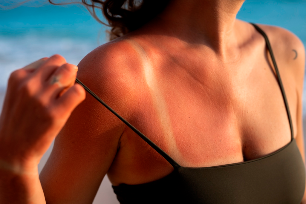 Pós-sol: descubra os benefícios e como incorporar em sua rotina nos dias quentes